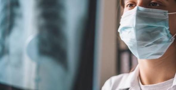 Arts kijkt naar longenfoto