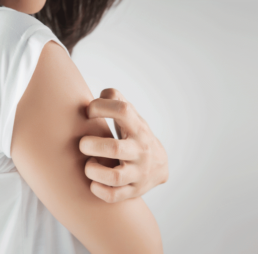 Vrouw in wit shirt krabt aan haar arm